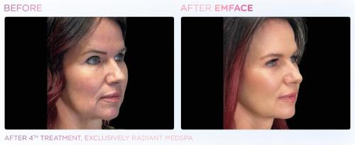 Emface PIC Ba-card-female-face-062 ENUS100 res