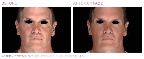Emface PIC Ba-card-male-face-053 ENUS100 res